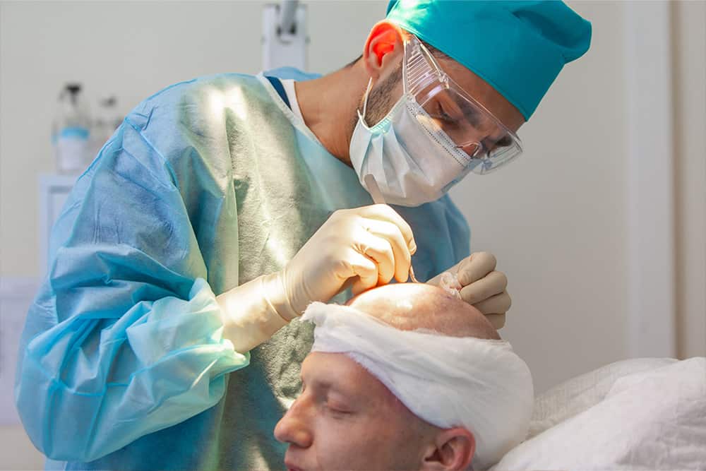 Hårtransplantation for at dække hårtab Hårtransplantation for at dække hårtab